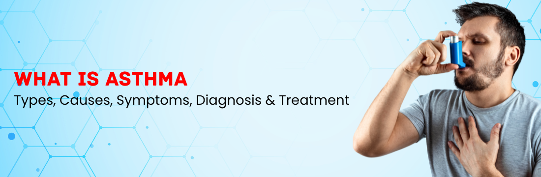 What is Asthma: Types, Causes, Symptoms, Diagnosis & Treatment